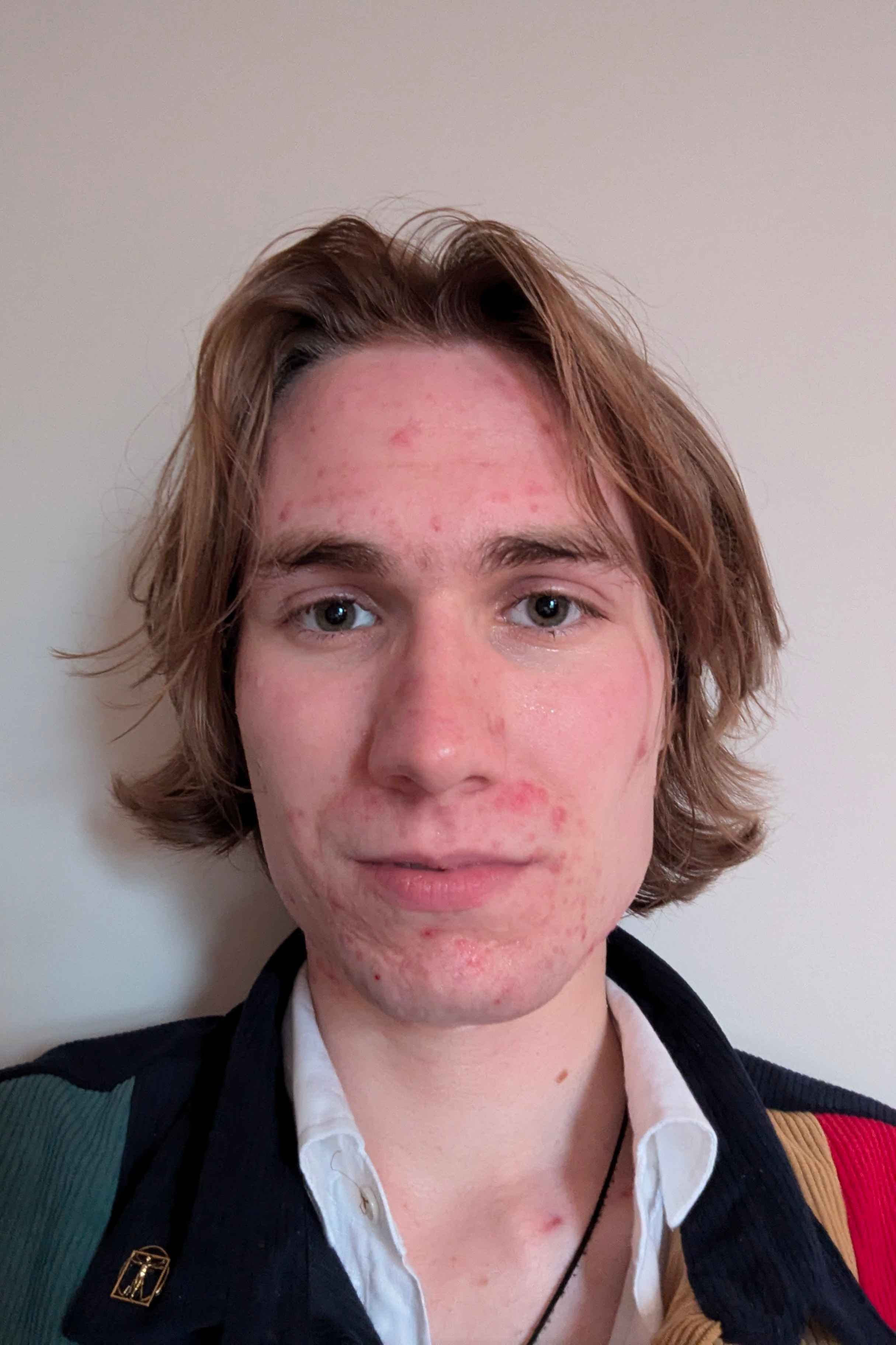 Harry Newton